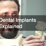 Dental Implants Explained