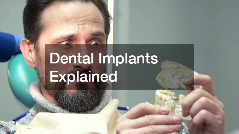 Dental Implants Explained